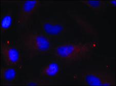 Anti-phospho-PAK1/PAK2/PAK3 (pThr423/pThr402/pThr421) antibody produced in rabbit affinity isolated antibody