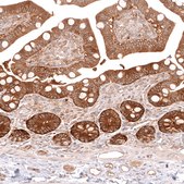 Monoclonal Anti-Cmpk2 Antibody Produced In Mouse Prestige Antibodies® Powered by Atlas Antibodies, clone CL14479, affinity isolated antibody, buffered aqueous glycerol solution