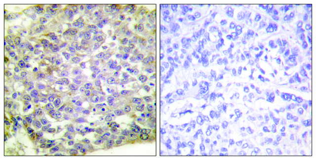 Anti-14-3-3 &#950; antibody produced in rabbit affinity isolated antibody