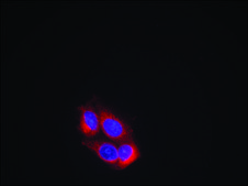 Anti-KDR (Ab-951) antibody produced in rabbit affinity isolated antibody