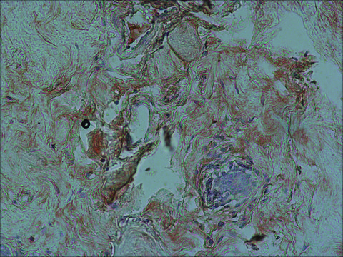 Anti-FKHRL1 (FOXO3a) antibody produced in rabbit affinity isolated antibody, buffered aqueous solution