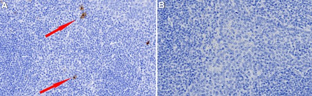 Anti-CD83 Antibody, clone 1I15 ZooMAb&#174; Rabbit Monoclonal recombinant, expressed in HEK 293 cells