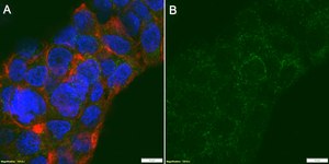 Anti-PNPLA3 Antibody, clone 11C5 ZooMAb® Mouse Monoclonal recombinant, expressed in HEK 293 cells