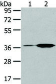 Anti-TBXA2R affinity isolated antibody