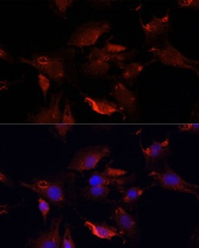 Anti-TYMS antibody produced in rabbit