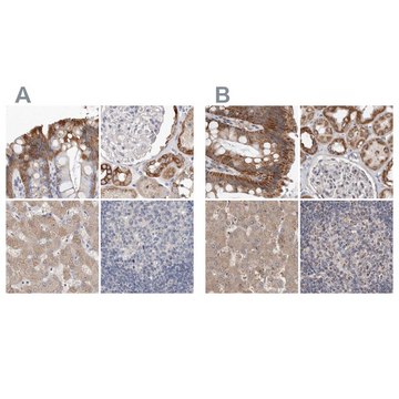 Anti-MRPL18 antibody produced in rabbit Prestige Antibodies&#174; Powered by Atlas Antibodies, affinity isolated antibody, buffered aqueous glycerol solution, ab2