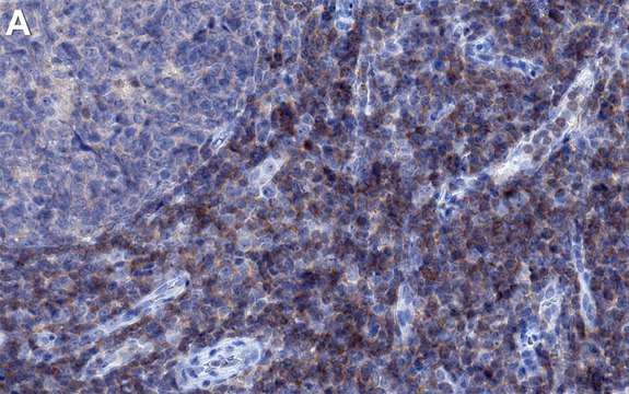 Anti-PI3-Kinase p85α Antibody, clone 3D12 ZooMAb&#174; Rabbit Monoclonal recombinant, expressed in HEK 293 cells