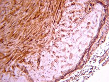 Anti-Procollagen Type III PIIINP Antibody Chemicon®, from rabbit