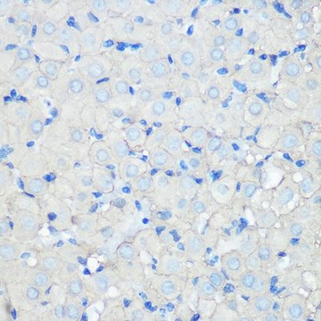 Anti-SR-BI antibody produced in rabbit