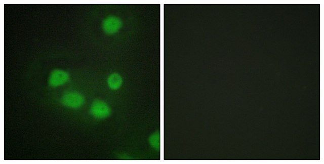 Anti-SIX6 antibody produced in rabbit affinity isolated antibody