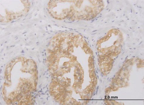 Monoclonal Anti-RIPK2, (C-terminal) antibody produced in mouse clone 6F7, purified immunoglobulin, buffered aqueous solution