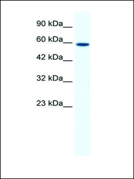 Anti-DDX5 (AB2) antibody produced in rabbit IgG fraction of antiserum