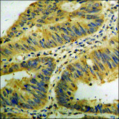 Anti-phospho-DAPK2 (pSer318) antibody produced in rabbit affinity isolated antibody