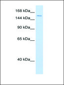 Anti-DHX9 antibody produced in rabbit affinity isolated antibody