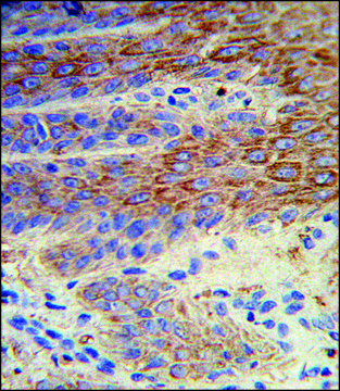 ANTI-ATP12A (CENTER) antibody produced in rabbit IgG fraction of antiserum, buffered aqueous solution