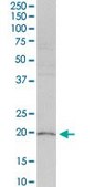 Anti-HRASLS3 antibody produced in rabbit purified immunoglobulin, buffered aqueous solution
