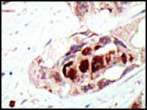 Anti-UBA2 (N-term) antibody produced in rabbit IgG fraction of antiserum, buffered aqueous solution