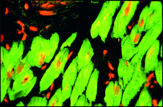 Monoclonal Anti-Troponin T antibody produced in mouse clone JLT-12, ascites fluid