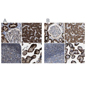 Anti-HIBADH antibody produced in rabbit Prestige Antibodies&#174; Powered by Atlas Antibodies, affinity isolated antibody, buffered aqueous glycerol solution, Ab2