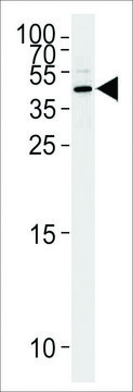 ANTI-MASPIN (CENTER) antibody produced in rabbit affinity isolated antibody, buffered aqueous solution