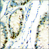 Anti-phospho-RFWD2 (pSer387) antibody produced in rabbit affinity isolated antibody