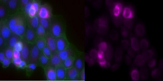 Anti-Laminin-5 Antibody (&#947;2 chain), clone D4B5, Alexa Fluor&#8482; 647 Conjugate clone D4B5, from mouse, ALEXA FLUOR&#8482; 647