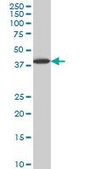 Monoclonal Anti-LHX6 antibody produced in mouse clone 3E8, purified immunoglobulin, buffered aqueous solution