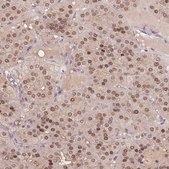Anti-TPI1 antibody produced in rabbit Prestige Antibodies® Powered by Atlas Antibodies, affinity isolated antibody