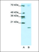 Anti-SRP19 antibody produced in rabbit IgG fraction of antiserum