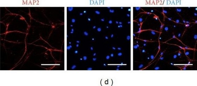 Anti-MAP2 (2a+2b) antibody, Mouse monoclonal ~2&#160;mg/mL, clone AP-20, purified from hybridoma cell culture