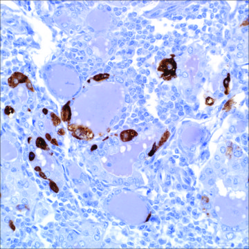 Calcitonin (SP17) Rabbit Monoclonal Antibody