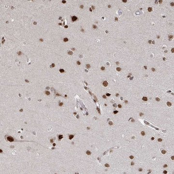 Anti-ZDHHC12 antibody produced in rabbit Prestige Antibodies&#174; Powered by Atlas Antibodies, affinity isolated antibody, buffered aqueous glycerol solution