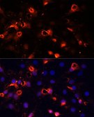 Anti-SMO antibody produced in rabbit