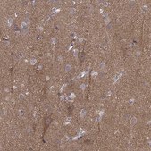 Anti-PEX5L antibody produced in rabbit Prestige Antibodies® Powered by Atlas Antibodies, affinity isolated antibody, buffered aqueous glycerol solution