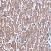 Anti-CDK18 antibody produced in rabbit Prestige Antibodies® Powered by Atlas Antibodies, affinity isolated antibody, buffered aqueous glycerol solution