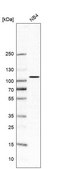 Anti-PALD1 antibody produced in rabbit Prestige Antibodies® Powered by Atlas Antibodies, affinity isolated antibody, buffered aqueous glycerol solution
