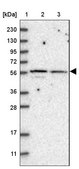 Anti-SH3BP2 antibody produced in rabbit Prestige Antibodies® Powered by Atlas Antibodies, affinity isolated antibody, buffered aqueous glycerol solution