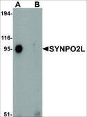 Anti-SYNPO2L antibody produced in rabbit affinity isolated antibody, buffered aqueous solution