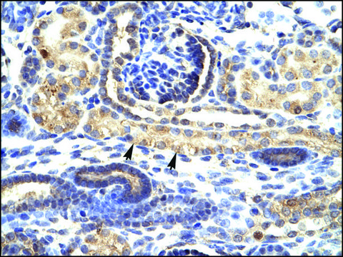 Anti-SNAI1 antibody produced in rabbit affinity isolated antibody