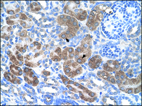 Anti-CD36 antibody produced in rabbit affinity isolated antibody