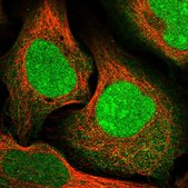 Anti-CCDC82 antibody produced in rabbit Prestige Antibodies® Powered by Atlas Antibodies, affinity isolated antibody, buffered aqueous glycerol solution