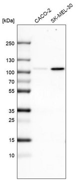 Monoclonal Anti-SOX6 antibody produced in mouse Prestige Antibodies&#174; Powered by Atlas Antibodies, clone CL5685, purified immunoglobulin, buffered aqueous glycerol solution