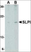 Anti-SLPI (ab2) antibody produced in rabbit affinity isolated antibody, buffered aqueous solution