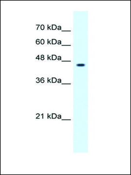 Anti-GLIS3 antibody produced in rabbit affinity isolated antibody