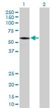 Anti-IFT57 antibody produced in rabbit purified immunoglobulin, buffered aqueous solution