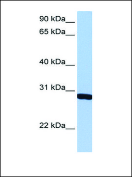 Anti-SMN1 antibody produced in rabbit affinity isolated antibody