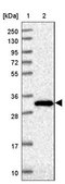 Anti-ABHD17C antibody produced in rabbit Prestige Antibodies® Powered by Atlas Antibodies, affinity isolated antibody, buffered aqueous glycerol solution