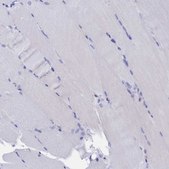 Anti-TM4SF4 antibody produced in rabbit Prestige Antibodies® Powered by Atlas Antibodies, affinity isolated antibody, buffered aqueous glycerol solution