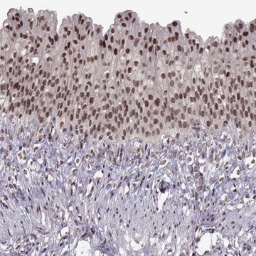 Anti-MT1E antibody produced in rabbit Prestige Antibodies&#174; Powered by Atlas Antibodies, affinity isolated antibody, buffered aqueous glycerol solution