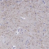 Anti-LAMP5 antibody produced in rabbit Prestige Antibodies® Powered by Atlas Antibodies, affinity isolated antibody, buffered aqueous glycerol solution
